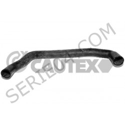 radiator outlet hose